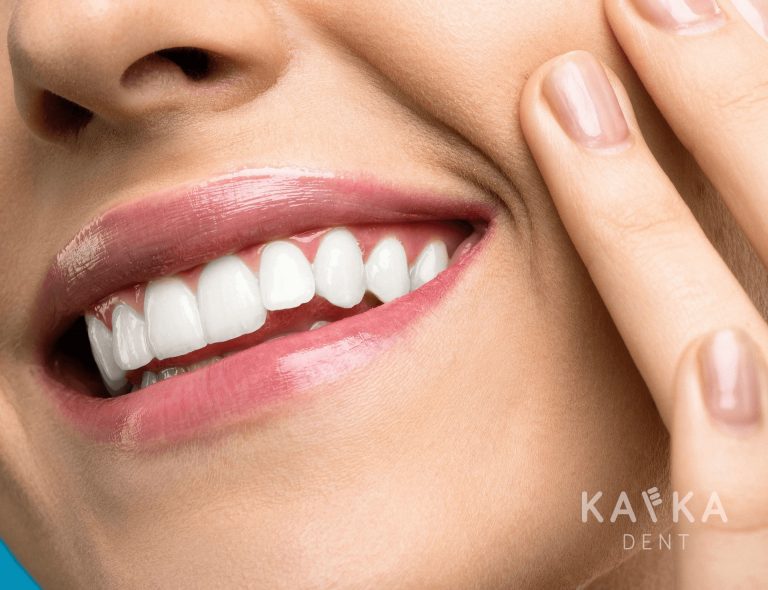 Pekné zuby – Kafka Dent, Nové zuby – spokojnosť, zdravie a sebadôvera