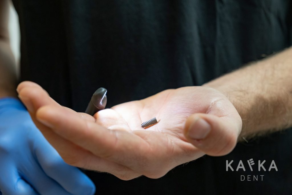 Zubný implantát Kafka Dent