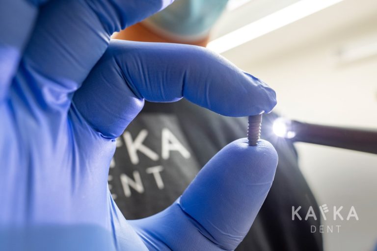 Zubný implantát Kafka Dent