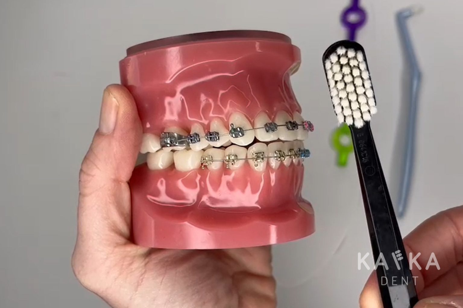 Čistenie fixného strojčeka, Video: Ako správne čistiť fixný strojček na zuby