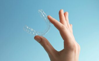 Neviditeľné  strojčeky Invisalign, Spark a Angel Aligners sú najlepšou voľbou